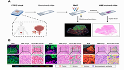 Development and validation of artificial intelligence-based model for bladder cancer immunophenotyping using whole slide images